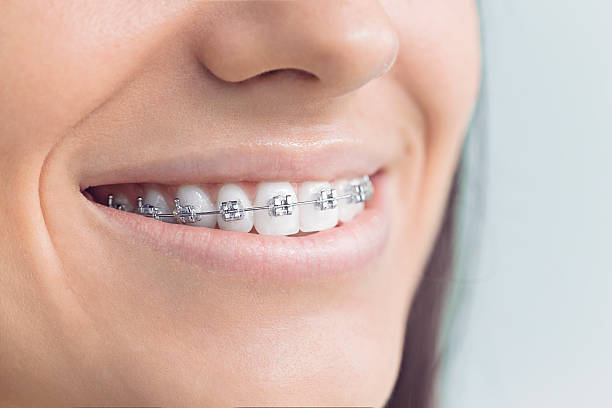 Best Teeth Whitening  in Marshall, IL